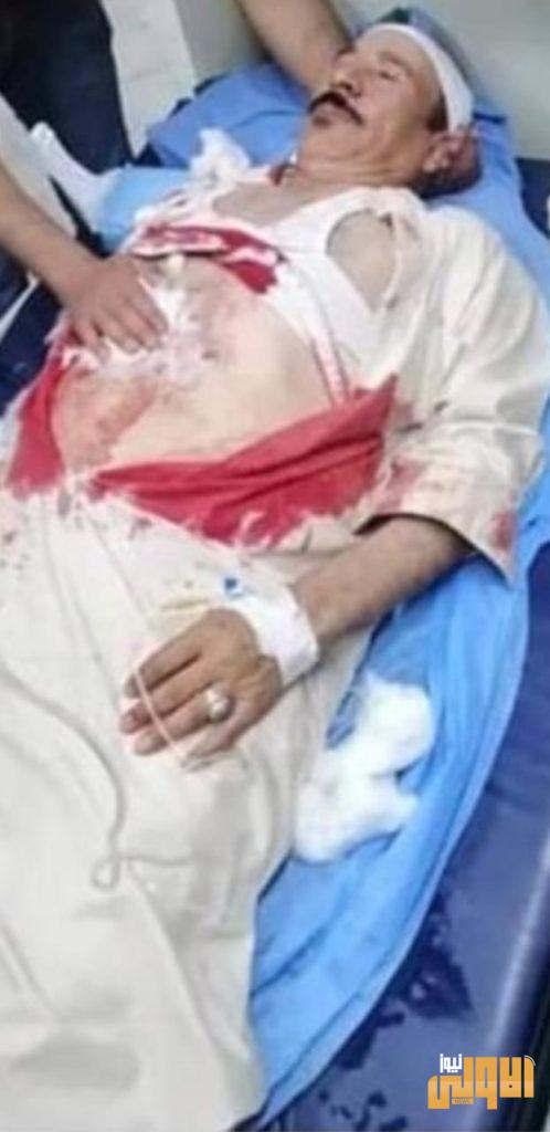 هجوم بواسطة رمانة يدوية يحول زفافاً الى حمام دم 17 067C16E4 7856 4CA3 B0C8 48832D4C16D9