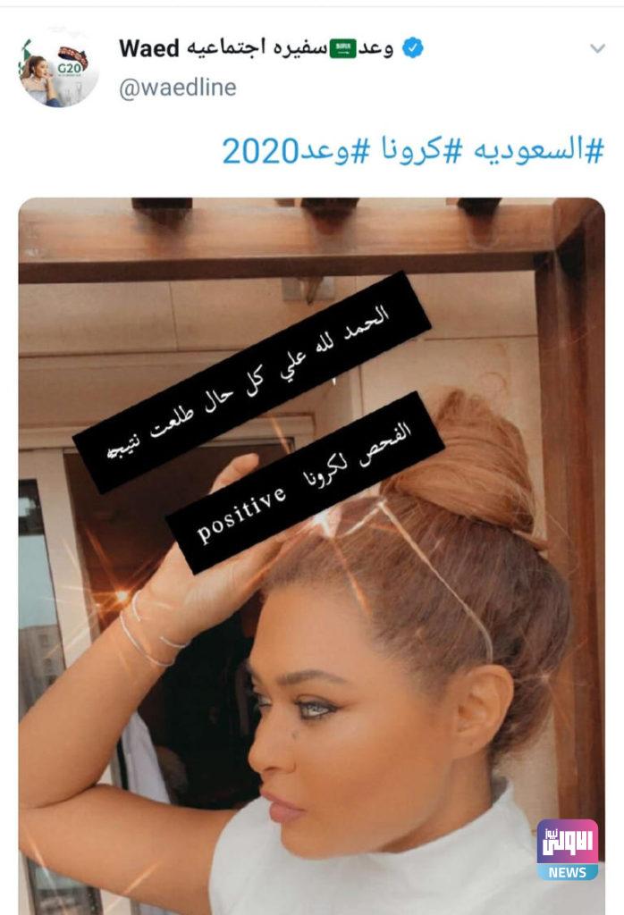 إصابة الفنانة السعودية وعد بفيروس كورونا 4 127 103549 the saudi artist waad corona virus 2
