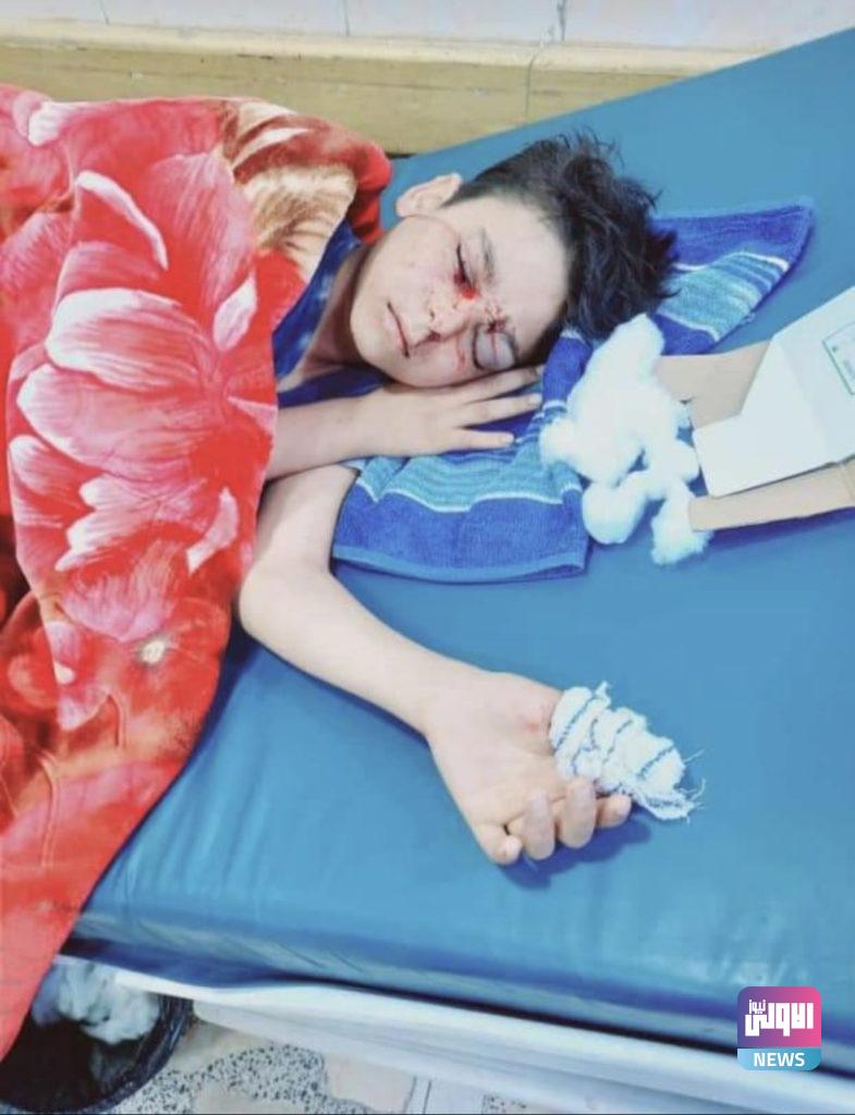 طفل يفقد نظره بسبب عبثه بالسلاح وانطلاق النار بالخطأ في البصرة(صور) 6 66C513C3 AE33 4066 BCE8 860110651EC1