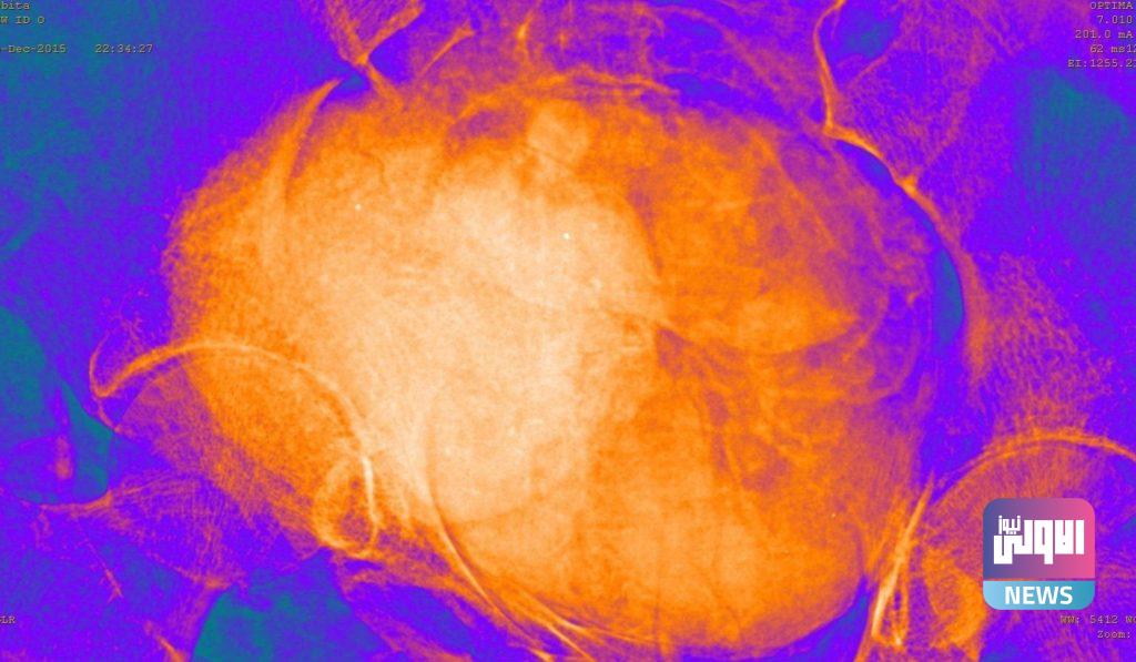 مومياء حامل..بعد عدة فحوصات في متحف بولندي 20 ٢٠٢١٠٤٢٩ ٢٣٢٤٢١