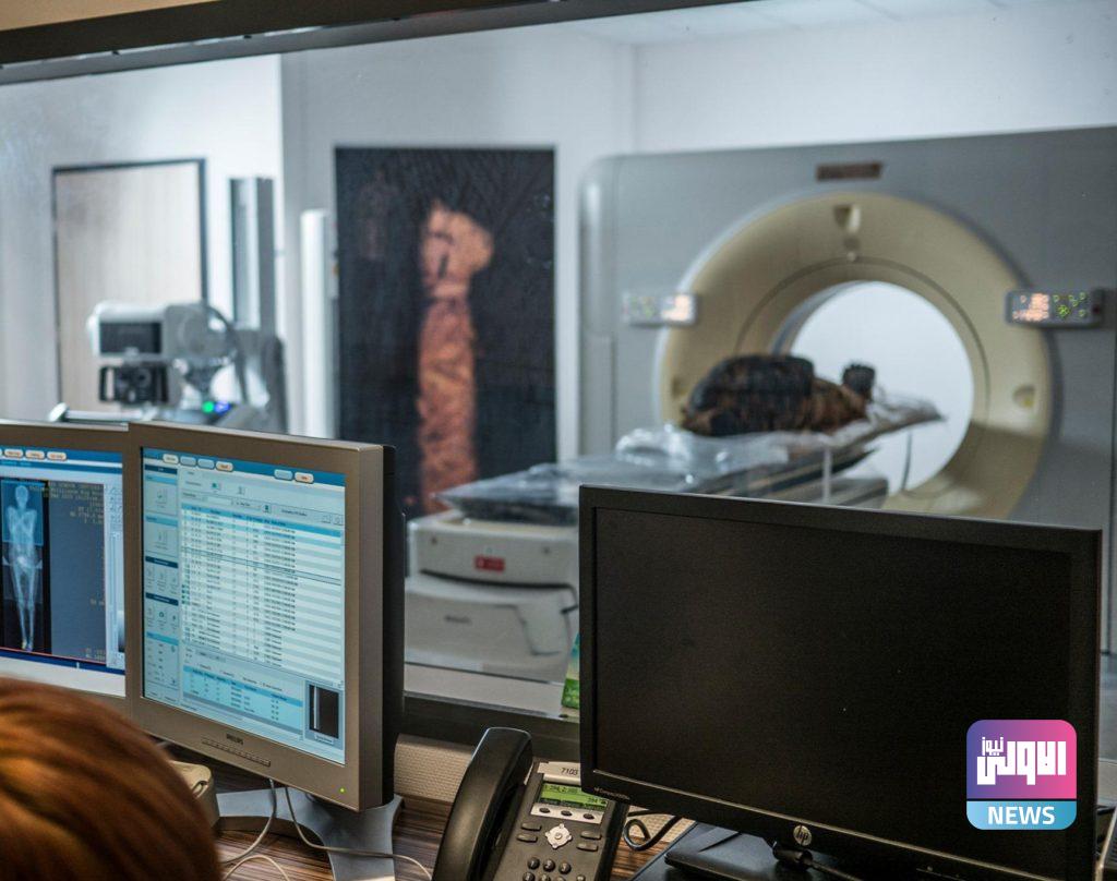 مومياء حامل..بعد عدة فحوصات في متحف بولندي 19 ٢٠٢١٠٤٢٩ ٢٣٢٤٣١