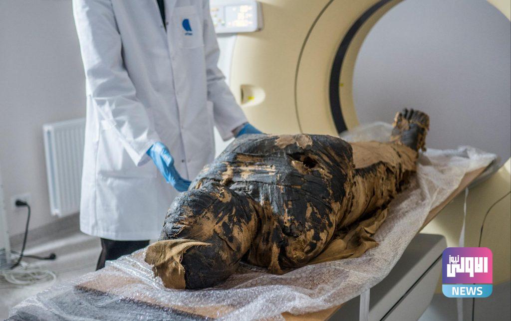 مومياء حامل..بعد عدة فحوصات في متحف بولندي 18 ٢٠٢١٠٤٢٩ ٢٣٢٤٤١