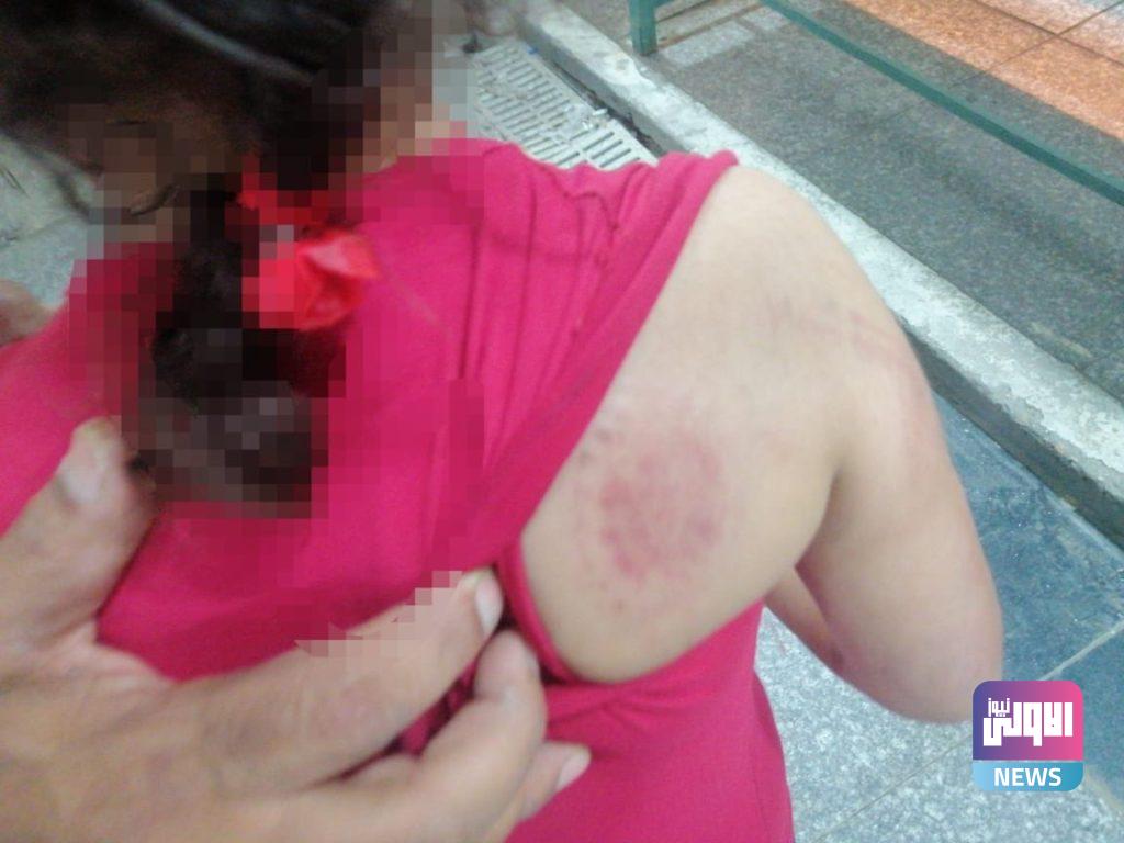 طفلة تتعرض لتعنيف من قبل والدتها في كربلاء(صور) 10 9275202148989c2b a670 4aee 8470 a9ba2dbdb8ba