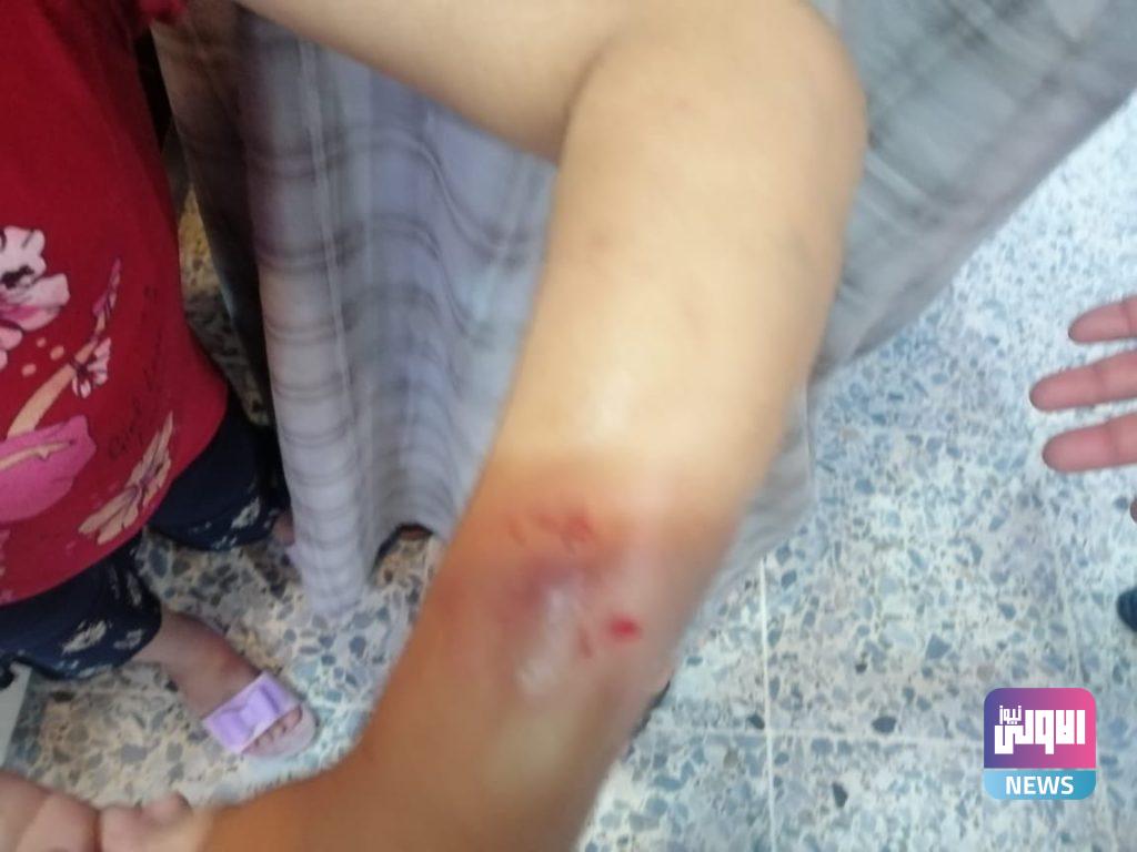 طفلة تتعرض لتعنيف من قبل والدتها في كربلاء(صور) 12 92752021eab7904f bd50 4675 9436 9584a2209e82