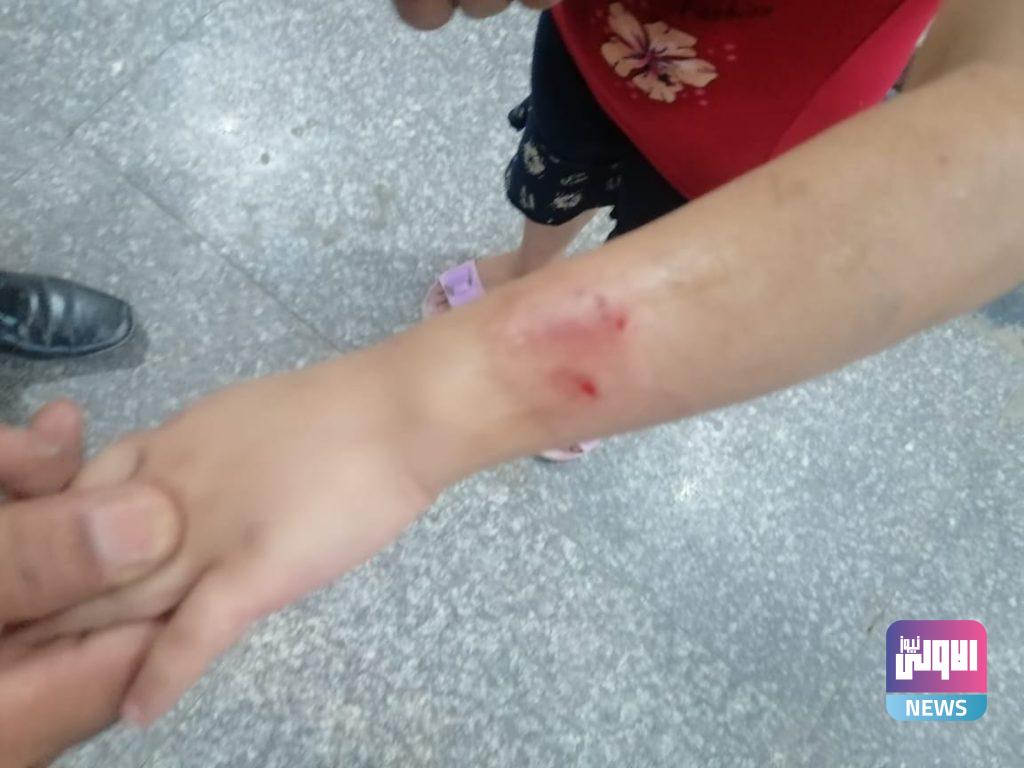 طفلة تتعرض لتعنيف من قبل والدتها في كربلاء(صور) 11 92752021f59bc776 3849 4c15 9637 06500b39f8de