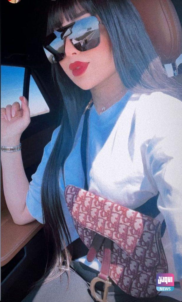 دنيا بطمة تواجه انتقادات بعد تغيير ملامحها..بالصور 6 176 102911 criticism dounia batma after changing features 2