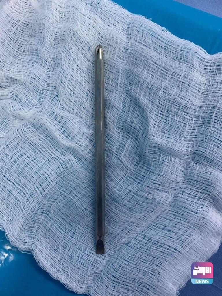 انقاذ رجل أصيب بمفك براغي "درنفيس" بالفقرات العنقية ونفذ للحبل الشوكي 22 934840F3 727A 4CD7 96D6 48EF08D08A3C