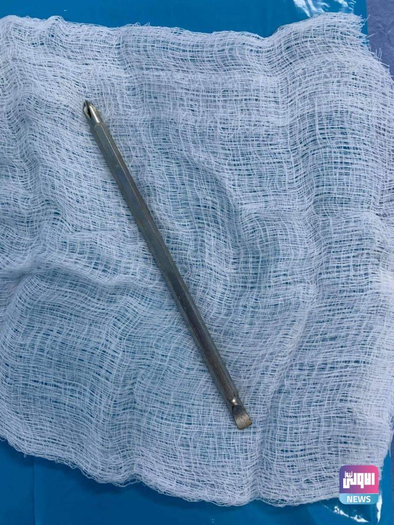 انقاذ رجل أصيب بمفك براغي "درنفيس" بالفقرات العنقية ونفذ للحبل الشوكي 21 C018BFF4 1C89 4832 8769 7B06A1607BC7